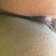 anal anal